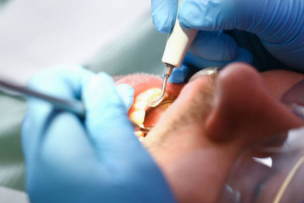 Best Emergency Dental Surgery in East Dennis, MA