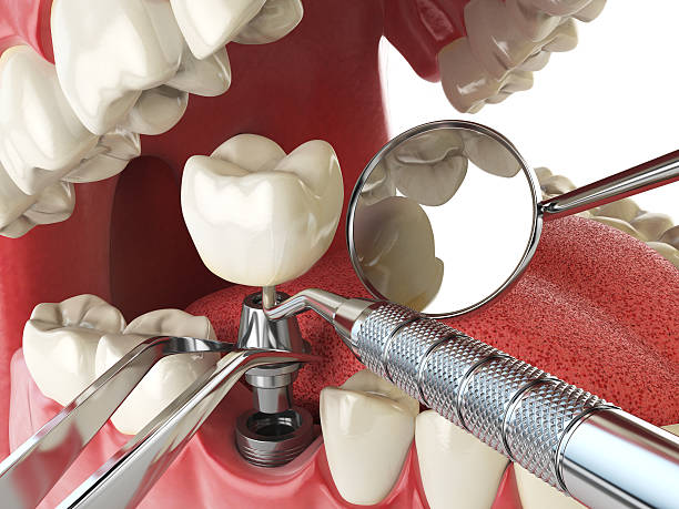 Best Emergency Broken Tooth Repair in East Dennis, MA